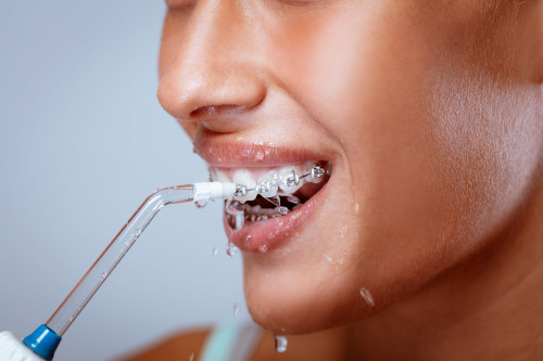 Как правильно пользоваться ирригатором для ухода за полостью рта