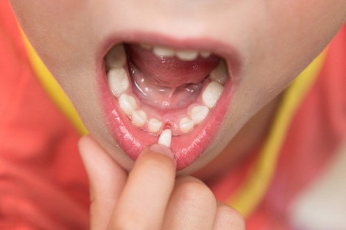 Как происходит процесс замены молочных зубов на коренные?