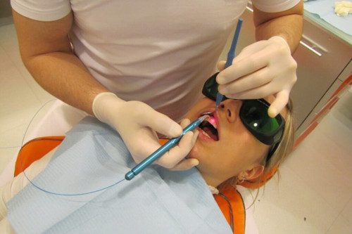 Возможности и преимущества лазерной стоматологии