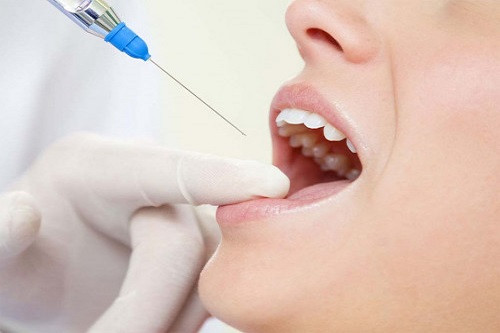 Основные типы стоматологической анестезии