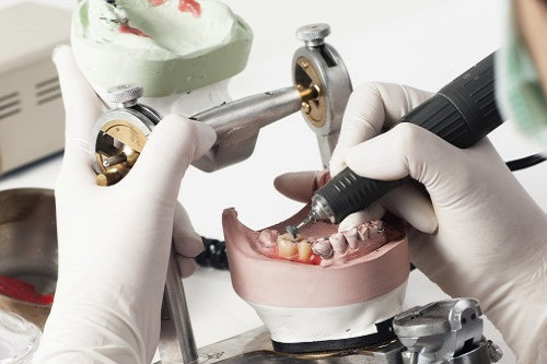 Зубной техник - кто это и что он делает?