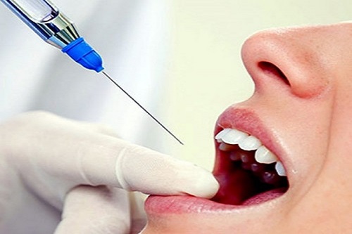 Какие технологии обезболивания в стоматологии существуют?