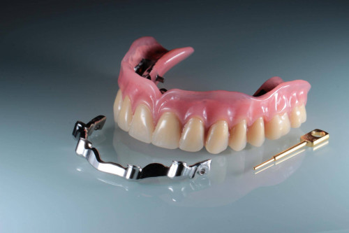 Основные особенности съемных зубных протезов