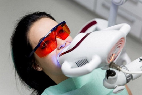 Виды отбеливания зубов и их ключевые особенности