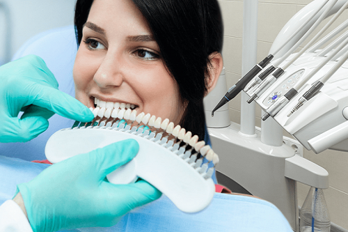 Классификация зубных виниров с описанием их характеристик