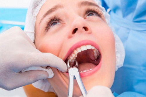 Что нужно делать в первые сутки после удаления зуба