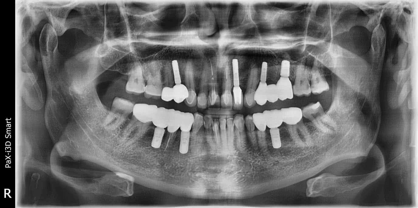 Зубы до процедуры 