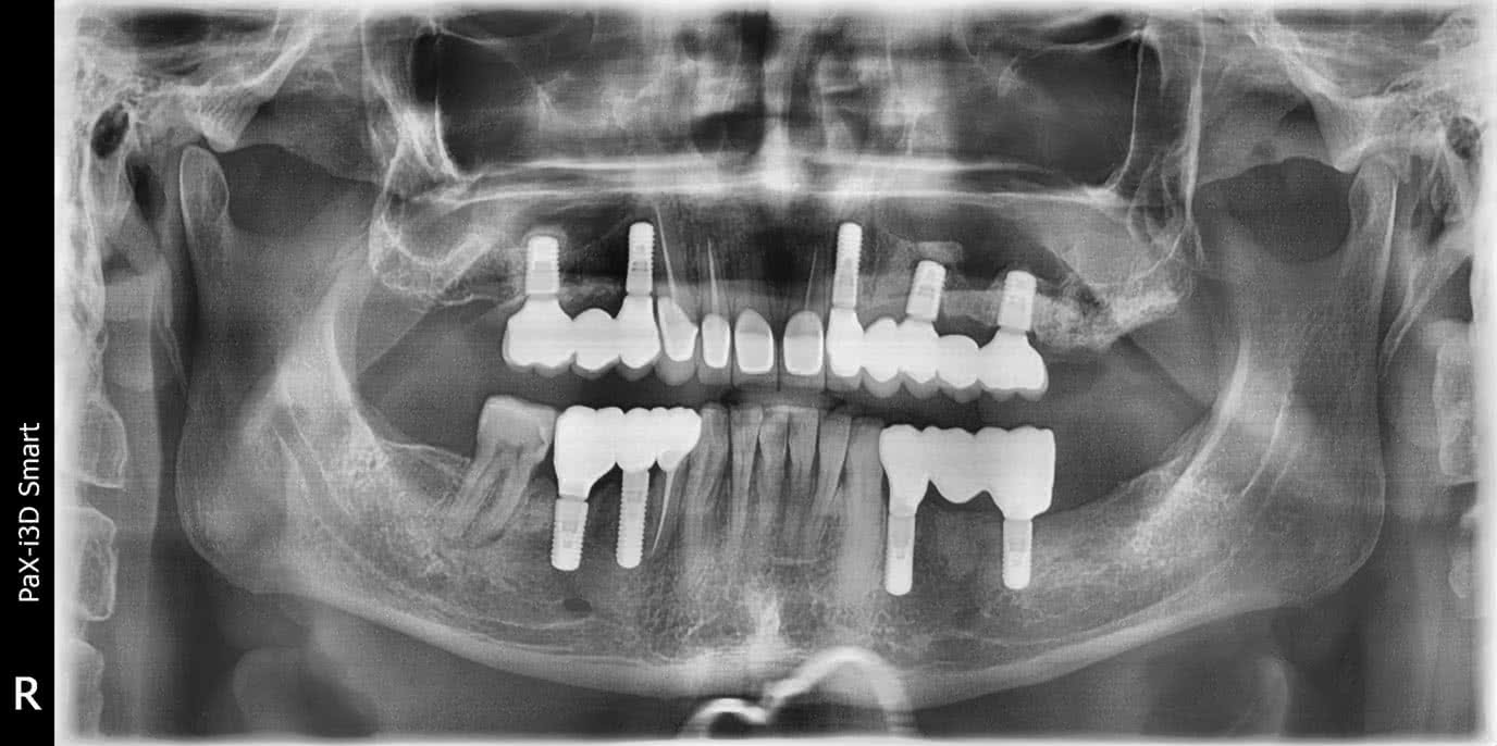 Зубы до процедуры 